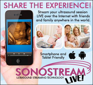 4D ultrasound streaming video to share your 3D ultrasound session with friends and family over the Internet via Sonostream LIVE